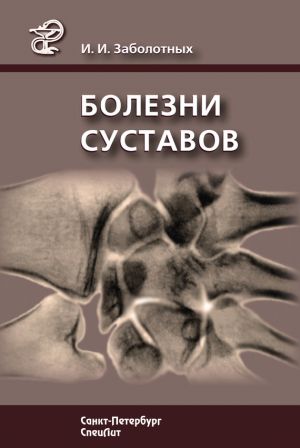 обложка книги Болезни суставов автора Инга Заболотных