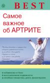 Книга Самое важное об артрите автора Ольга Родионова