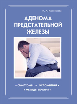обложка книги Аденома предстательной железы автора Ирина Калюжнова