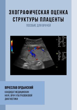 обложка книги Эхографическая оценка структуры плаценты автора Вячеслав Ордынский
