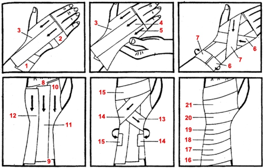 Тейпирование запястья схема