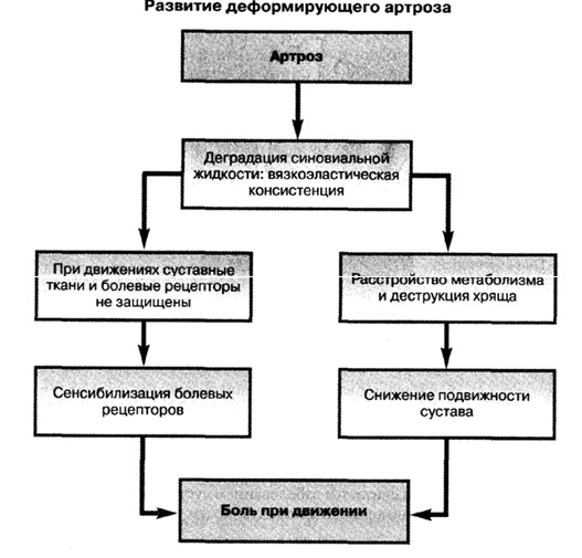 Схема лечения артроза