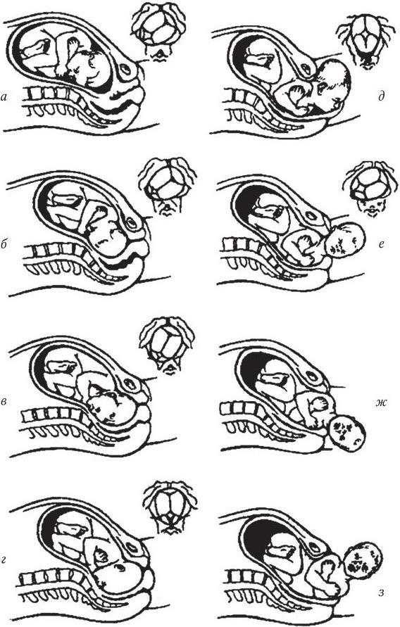 Виды затылочного предлежания. Передний вид затылочного предлежания биомеханизм родов. Биомеханизм родов задний вид. Биомеханизм родов при заднем затылочном предлежании. Задний вид затылочного предлежания биомеханизм родов.