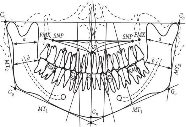 Схема описания ортопантомограммы