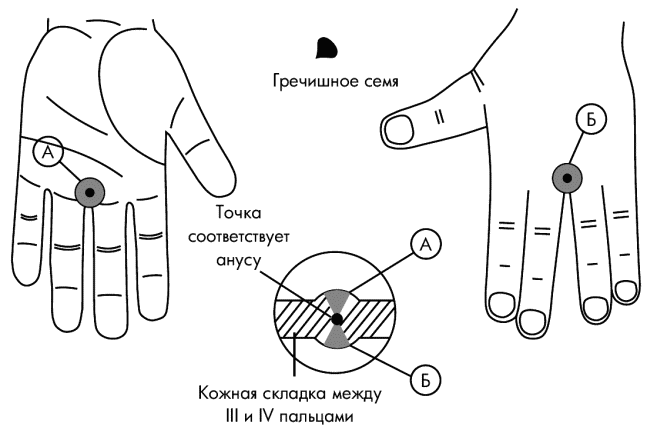 Против точки. Точки Су-Джок при запорах. Точки суджок при геморрое. Су Джок точка от запора. Точка Су Джок от геморроя.