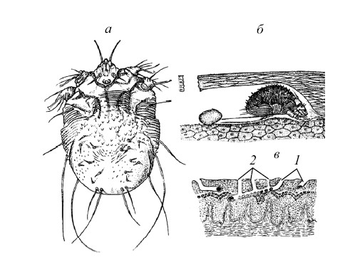 Цикл развития чесоточного клеща. Чесоточный клещ Sarcoptes scabiei. Жизненный цикл чесоточный клещ Sarcoptes scabie. Sarcoptes scabiei цикл развития. Чесоточный зудень жизненный цикл.