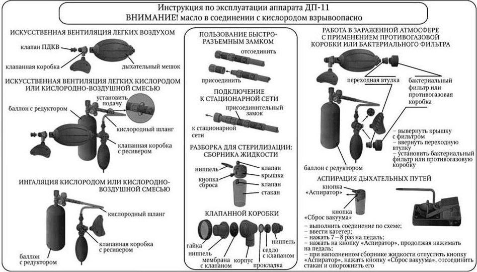 Схема работы ивл