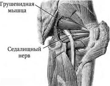 Симптом грушевидной мышцы