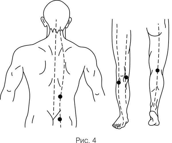Точки валле. Точки массажа при боли в пояснице. Точки на пояснице для снятия боли. Болевые точки Валле.