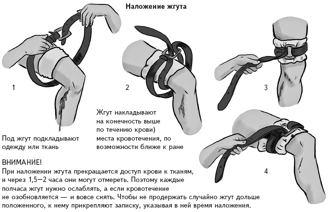 Наложение жгута при кровотечении картинка