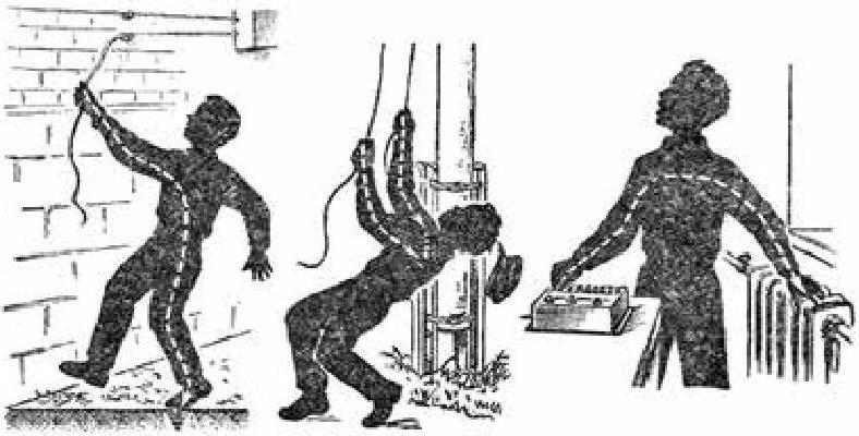 Случаи поражения электрическим током. Поражение человека электрическим током. Люди пораженные электрическим током.