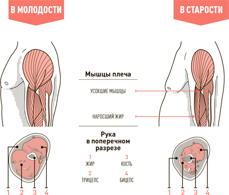 Изменение мышц в старости