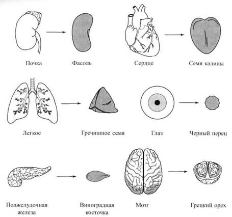 Перенос мозгов калина 1