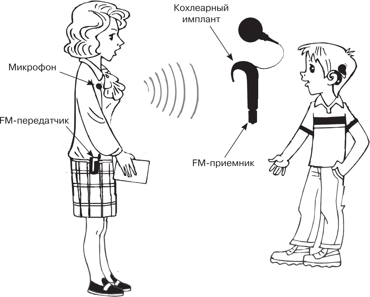 Схема работы кохлеарного импланта