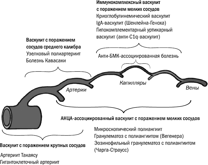 Отзывы лечения васкулита. Классификация васкулитов у детей. Системные васкулиты клинические рекомендации 2022. Системные васкулиты у детей классификация. Системные васкулиты этиология и патогенез.