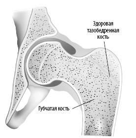 Трабекулярный рисунок кости