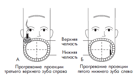 Зубная точка. Су Джок болит зуб. Су Джок точки от зубной боли. Су Джок терапия при зубной боли. Точки Су Джок при зубной боли.