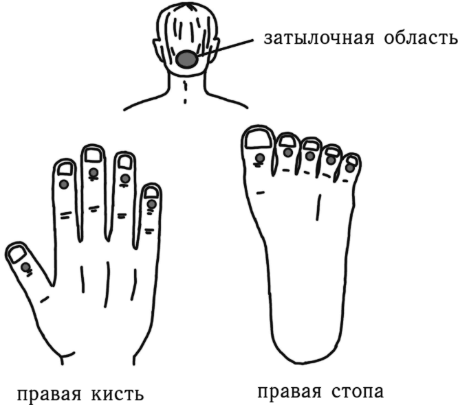 Точка соответствия. Су Джок при головной боли точки. Золотые точки акупунктуры. Точки акупунктуры для роста волос. Культевая диагностика Акупрессура.