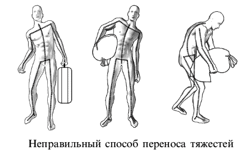 Неправильный способ. Способ переносить тяжести схема. Как переносить тяжести в бок.