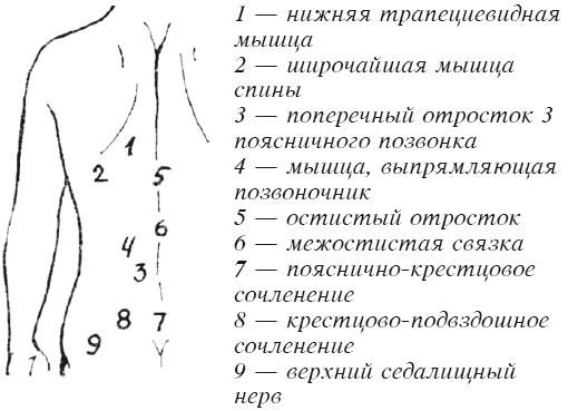 Банки при болях в пояснице схема