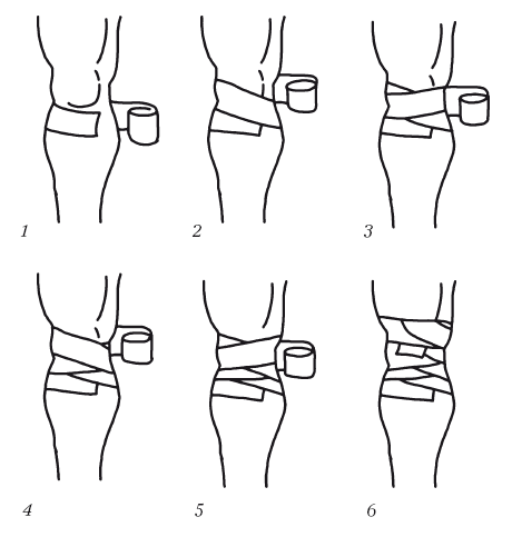 Как намотать на колено эластичный