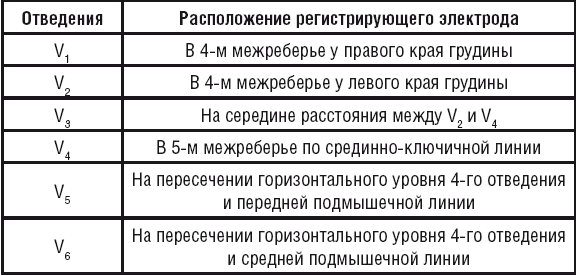 Экг как ставить электроды