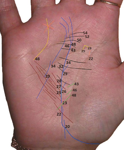 Точка ряд. Датировка линии судьбы. Линия влияния хиромантия. Датировка линий ладони. Возраст на линии судьбы.