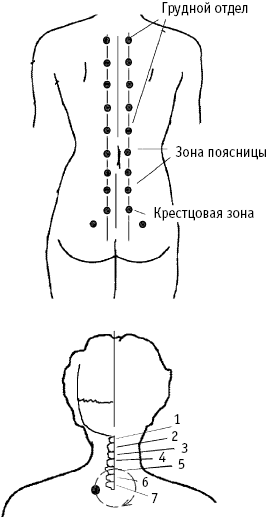 Схема баночного массажа шейного отдела