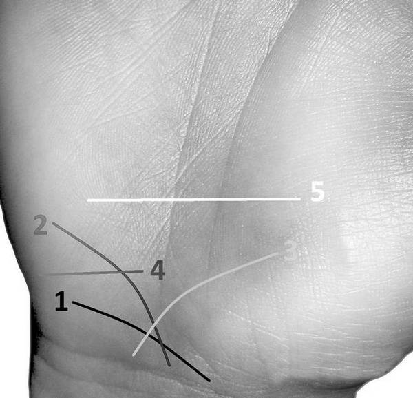 Линия виа ласцива на руке фото с расшифровкой