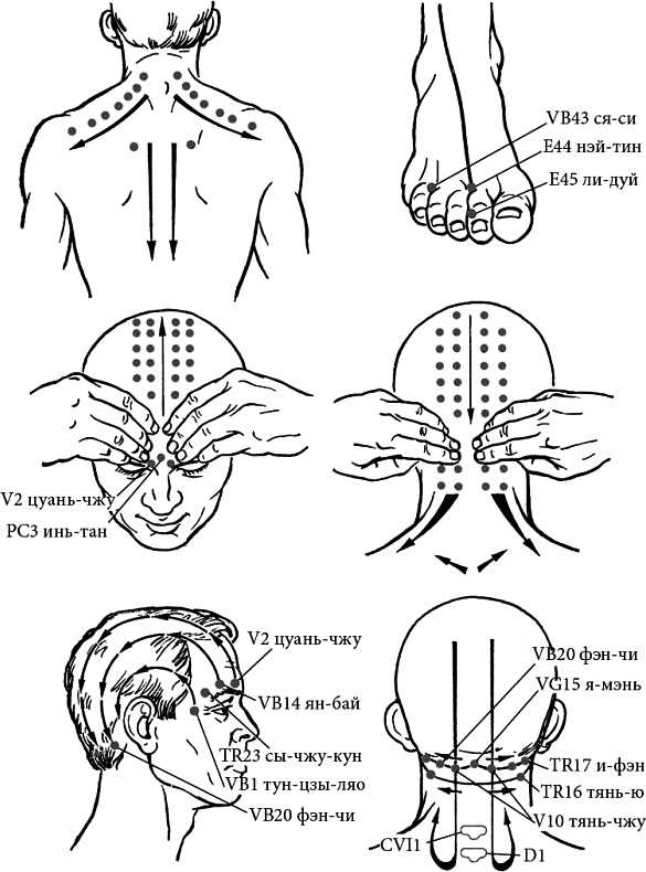 Точечный массаж классический. Точки для массирования при боли в голове. Точки акупунктуры при боли в голове. Точки самомассажа при головной боли. Мигрень акупунктурные точки.