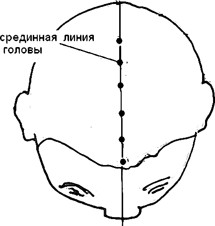 Средняя сагиттальная линия головы. Линии черепно-мозговой топографии кренлейна-Брюсовой. Схема кренлейна-Брюсовой. Срединная линия головы.
