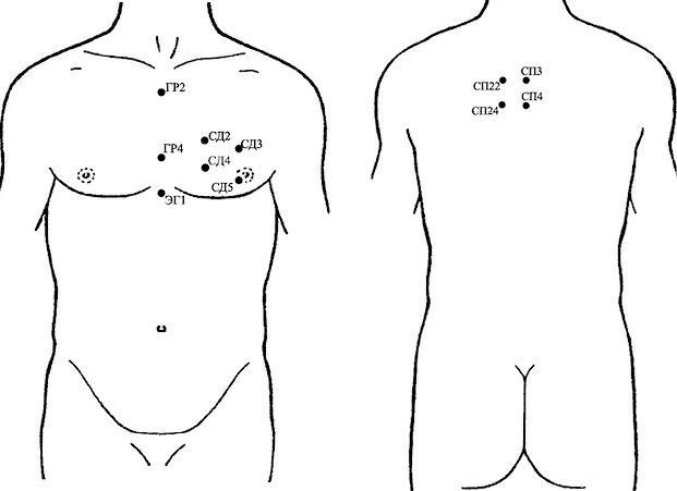 Схема точек пиявок. Схема постановки пиявок при ИБС. Схема постановки пиявок при стенокардии. Схема постановки пиявок на сердце. Схема постановки пиявок при панкреатите.