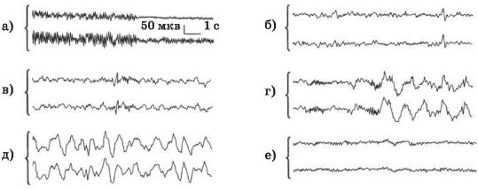 Рассмотрите рисунки изображающие электроэнцефалограммы спящего человека