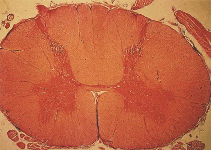 Фото спинного мозга человека в разрезе