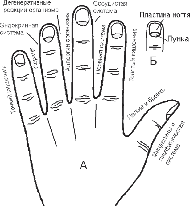 Определить заболевание по рукам. Диагностика по ногтям. Диагностика заболеваний по ногтям пальцев. Диагностика по ногтям на руках. Болезни по ногтям на руках таблица.