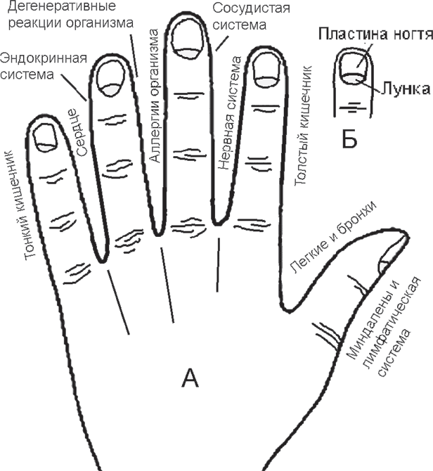 Что значат ногти. Диагностика по ногтям. Диагностика по ногтям на руках. Диагностика по пальцам рук. Определение здоровья по ногтям на руках.